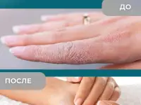 Крем для рук увлажняющий и питательный 150 мл, фотография 6