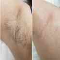 Депиляция сахарной пастой для женщин и мужчин, фотография 3