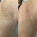 Депиляция(ШУГАРИНГ), фотография 3