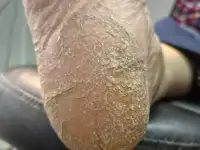 Услуги Подолога в Борисове, фотография 2