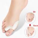 Избавьтесь от косточек на ногах с VALGUS PRO, фотография 2
