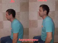 Акупрессура подзатылочных мышц, акупрессура височно-челюстных мышц, висцеральный миофасциальный релиз