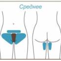 Шугаринг. Депиляция воском, фотография 3