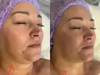 Массаж Сморгонь, фотография 6