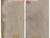 Шугаринг, фотография 2