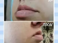 Депиляция воском и сахаром, фотография 2