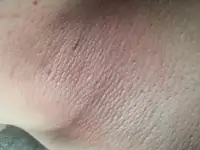 ДЕПИЛЯЦИЯ, фотография 7