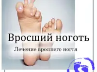 ПОДОЛОГ ПЕДИКЮР ГРОДНО, фотография 3