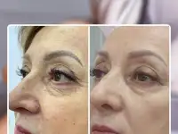 Массаж для похудения, фотография 4