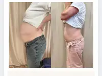 Массаж для похудения, фотография 2
