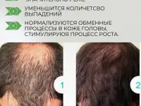 Бальзам маска для волос защита от выпадения и облысения, фотография 4