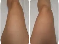 ДепиляцияШугаринг