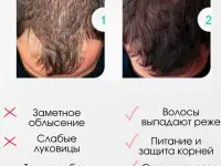 Шампунь для роста волос и бальзам против облысения, фотография 4