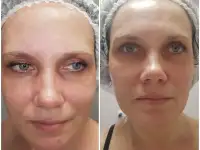Косметолог с медицинским образованием, фотография 2