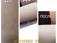 Шугаринг, фотография 4