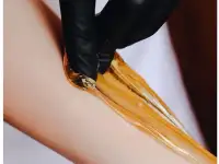 Депиляция Шугаринг, фотография 2