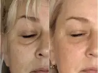 Сплитмассаж. Омоложение лица естественным способом. ., фотография 3