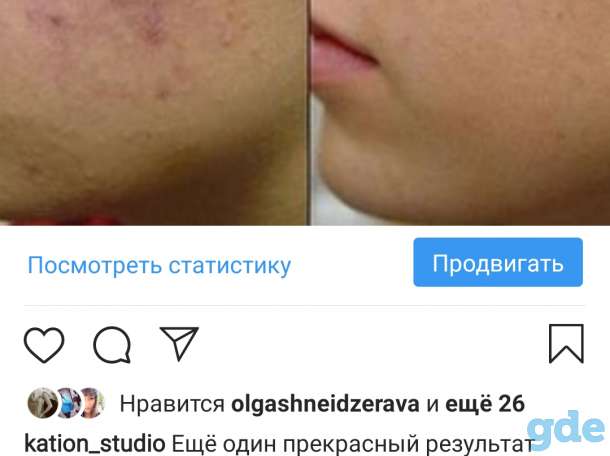 Все виды косметических процедур, фотография 6