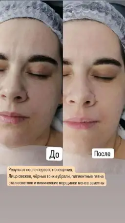 Косметик-эстетист, фотография 2
