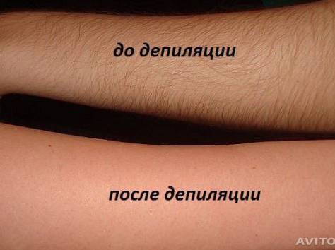 Депиляция(шугаринг).Блеск-тату, фотография 4