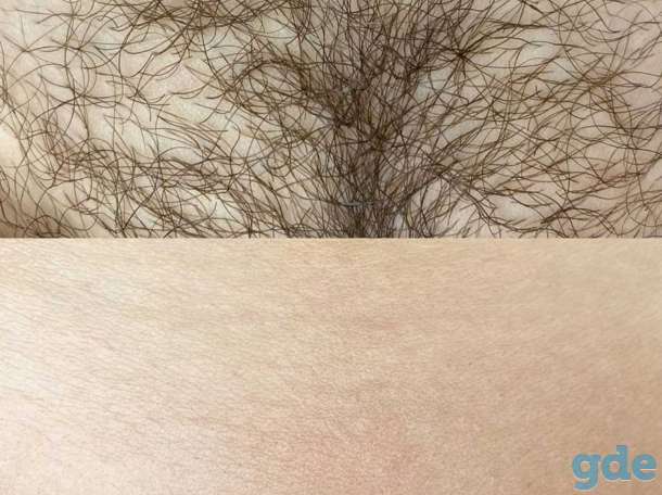 Депиляция сахарной пастой для женщин и мужчин, фотография 4