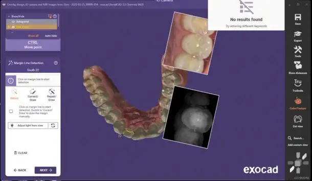 Exocad 3.3, Nemo 2025, HyperDent v9.4.5, 3Shape 2025, фотография 2