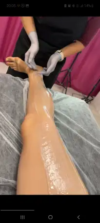 Депиляция ВоскШугаринг, фотография 1