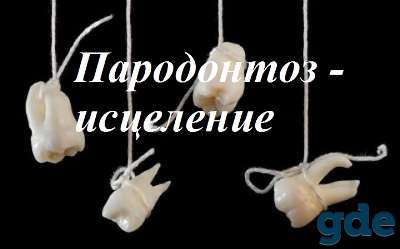 Пародонтоз - уникальный метод исцеления, фотография 1
