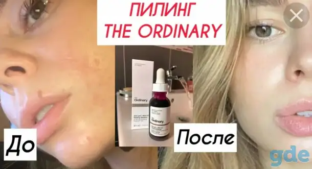 Пилинг, фотография 1