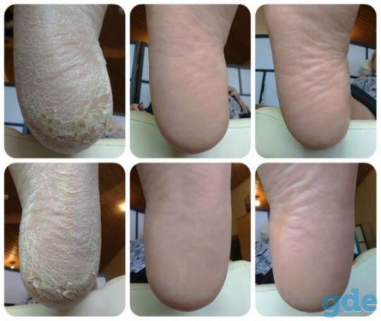 Маникюр педикюр в Гомеле, фотография 2