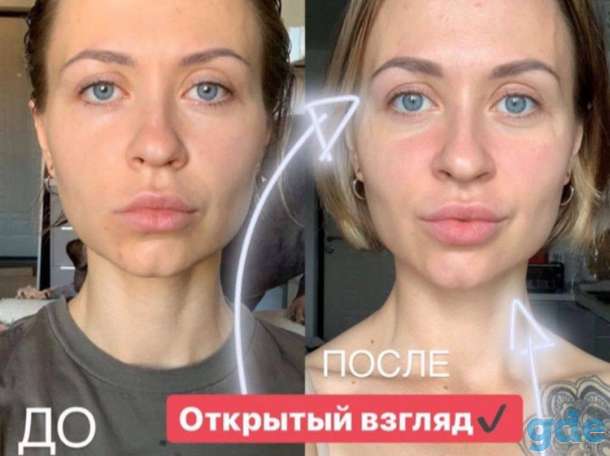 Коллаген, фотография 4