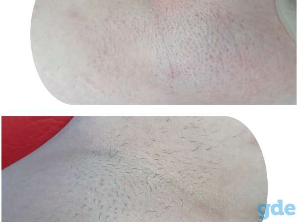 Окрашивание и оформление бровей и ресниц.  Депиляция, фотография 2