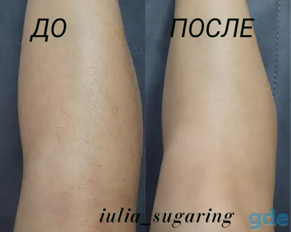 Депиляция/Шугаринг, фотография 1