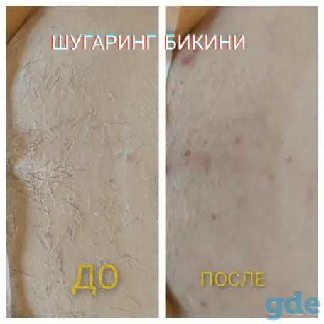 Шугаринг, фотография 2