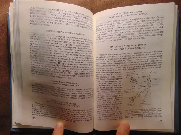 Срочная медицинская помощь в онкологии Издательство Медицина, 1985 год, 400 стр., Дж. У. Ярбро, Р. С. Борнстейн, фотография 7