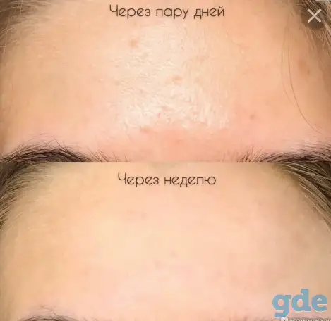 Сыворотка Ординари, фотография 3