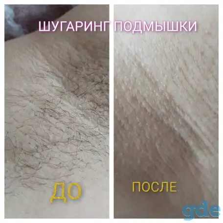Шугаринг, фотография 3