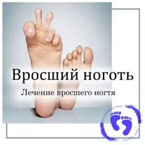 ПОДОЛОГ ПЕДИКЮР ГРОДНО, фотография 3