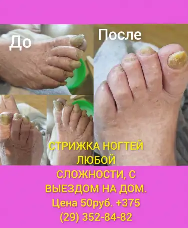 Стрижка ногтей педикюр маникюр, фотография 1