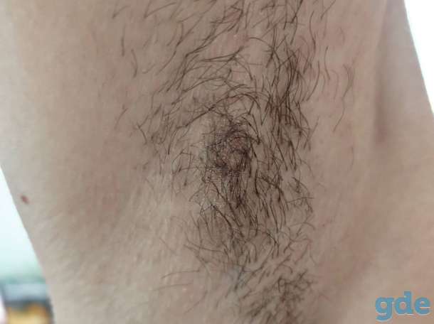 Шугаринг |депиляция, фотография 3