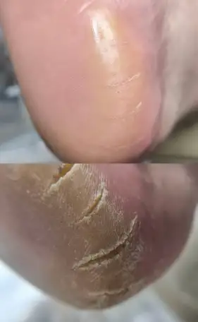 Маникюр. Педикюр., фотография 5