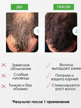 Шампунь для роста волос и бальзам против облысения, фотография 4