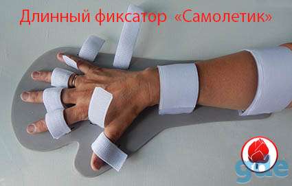 Фиксатор для руки после травмы, фотография 3