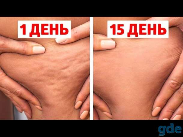 Массаж, фотография 1