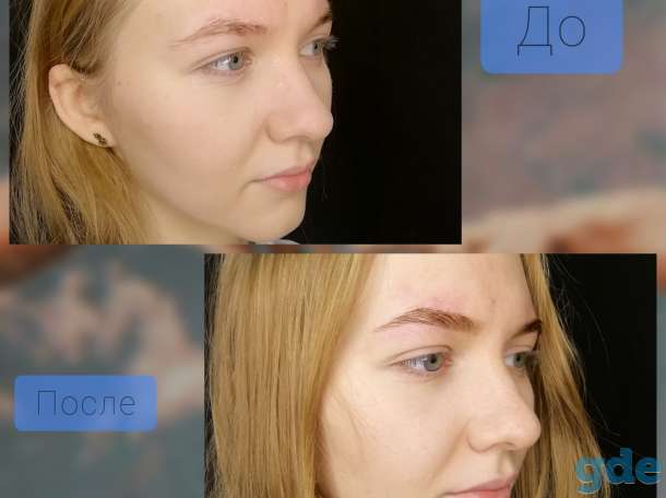 Бровист, фотография 4