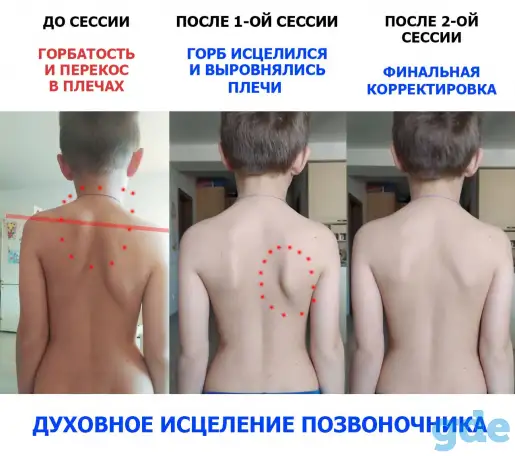 Выравнивание позвоночника дистанционно, фотография 1