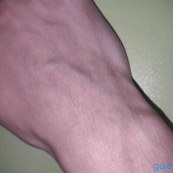 Шугаринг |депиляция, фотография 5