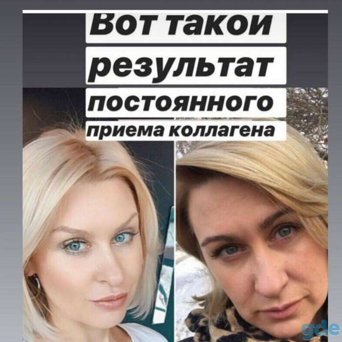 Коллаген, фотография 5