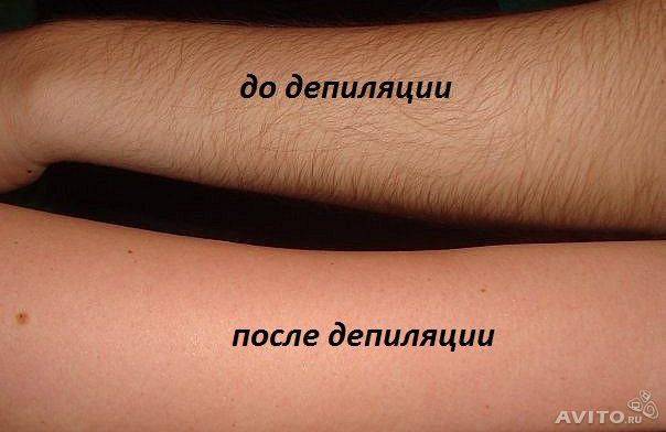 Депиляция(шугаринг).Блеск-тату, фотография 4