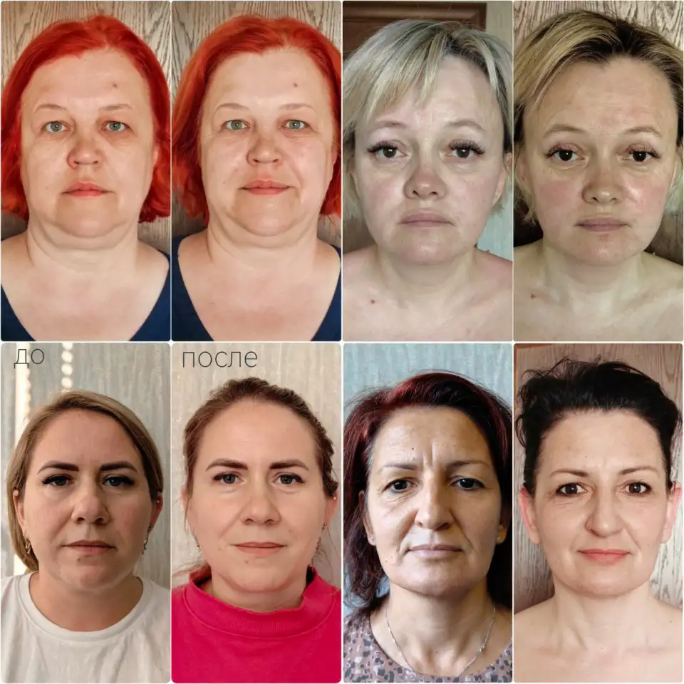 Сплитмассаж. Омоложение лица естественным способом. ., фотография 1